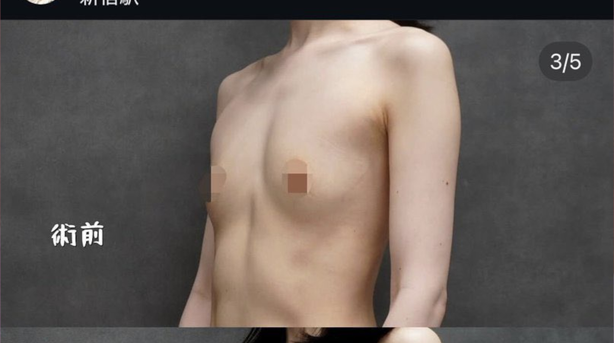 【画像】貧乳まんさん、巨乳になる